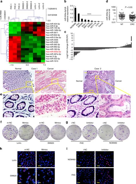 The P300 YY1 MiR 500a 5p HDAC2 Signalling Axis Regulates Cell