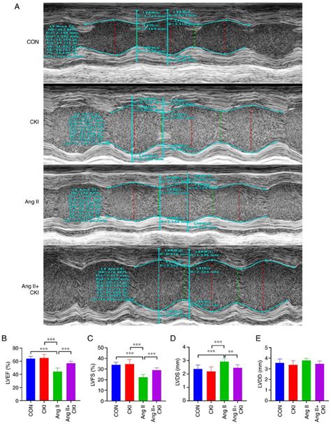 Doppler M Mode Ultrasonography And Markers Of Myocardial Injury In