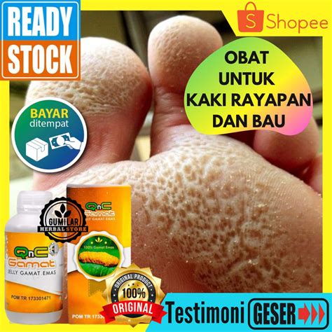 Jual Obat Oles Kaki Rayapan Bau Obat Telapak Kaki Rayapan Bolong