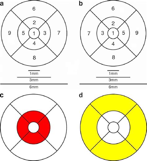 Etdrs Grid Nine Subfields Of The Nine Etdrs Regions In Each Eye A