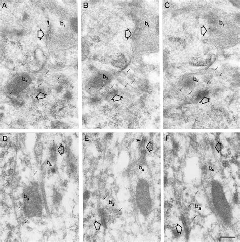 Comparison Of Immunolabelling For The A Subunit Of The Gaba A