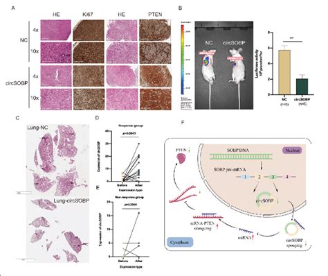 CircSOBP Suppresses The Metastasis Of BCa Tumor In Vivo A HE