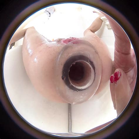 Lizzy Yum Glory Hole Dickdarm Und Anus K Ssen Kamera Post Op Anal