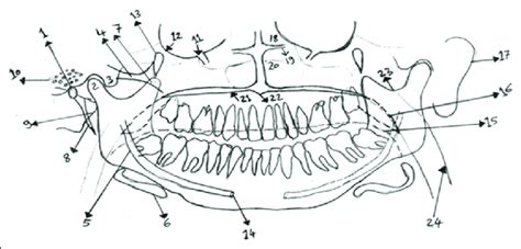 A Traced Panoramic Radiograph Used In The Examination The Numbers In