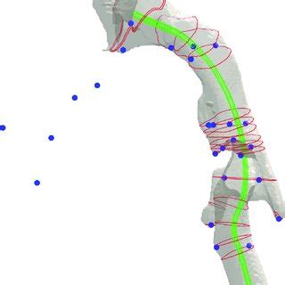 3D airway model (choanae to trachea) of a 4-year 8-month old typically ...