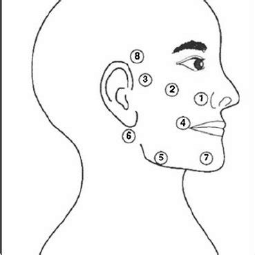 Point of laser application used in the treatment of Bell ’ s palsy... | Download Scientific Diagram