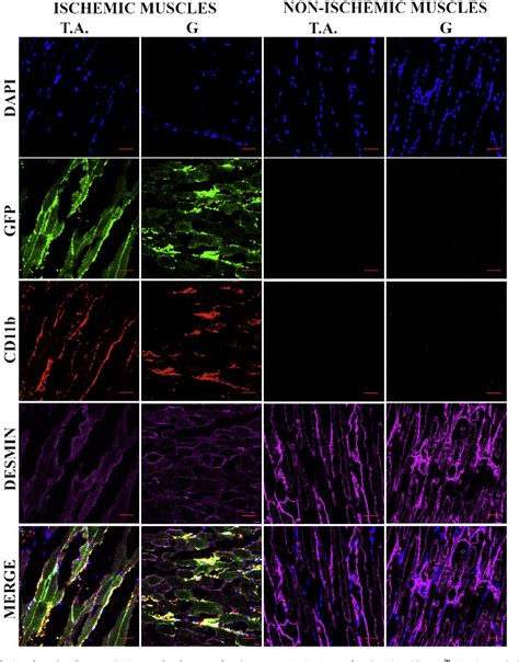 Figure 5 From Horizontal Gene Transfer From Macrophages To Ischemic