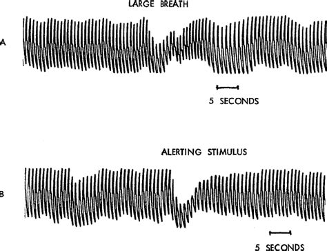 Figure 4 From Sexual History Disclosure Using The Polygraph Sexual