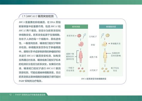 Parp抑制剂治疗卵巢癌患者指南卵巢癌抑制剂细胞癌症 健康界