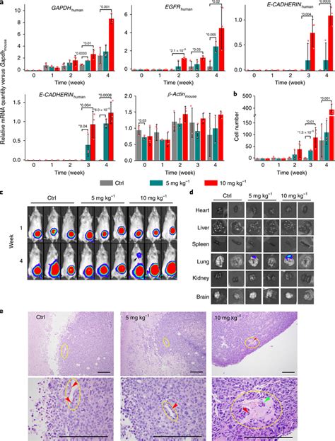 Tio2 Nps Promote The Intravasation Of Breast Cancer Cells In