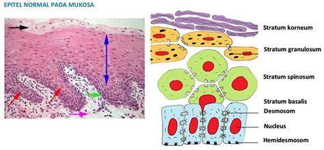 Epitel Normal Pada Mukosa Info Drg