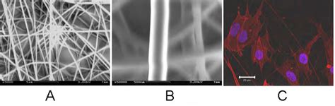 Growth Of Neonatal Human Dermal Fibroblasts On Electrospun Nanofibers