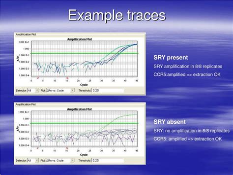 Ppt Non Invasive Diagnosis Of Fetal Sex Using Free Fetal Dna Our Experiences So Far