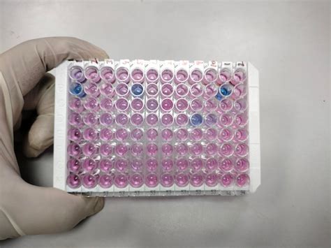 Premium Photo Enzyme Linked Immunosorbent Assay Elisa Plate