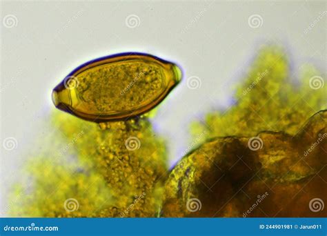 Egg Of Trichuris Trichiura Whipworm In Human Stool Stock Image Image