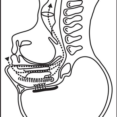 Esophageal Speech Figure 4 Electrolarynx Speech Download Scientific