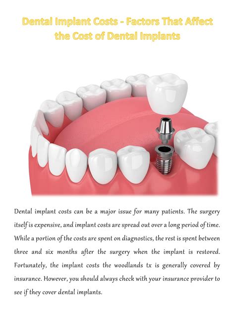 Dental Implant Costs Factors That Affect The Cost Of Dental Implants By Avinash Mittal Issuu