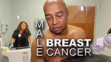 Men and Mammography | Early Detection of Male Breast Cancer - YouTube