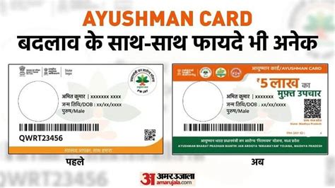 Ayushman Bharat Scheme These Holders Get Extra Benefits Know In Details