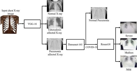 Chest X Ray Classification Using Deep Learning For Automated Covid 19