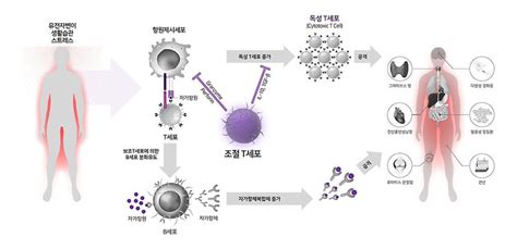 자가면역질환 원인 종류 치료방법