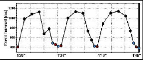 Typical canine heartbeat interval example showing variability over 3 ...