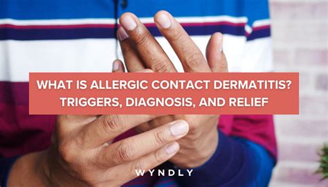 Allergic Contact Dermatitis: Symptoms, Causes, and Treatment (2023)#N# & Wyndly