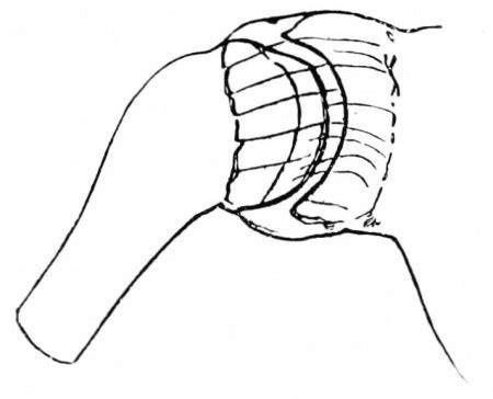 Ball & Socket Joint | Movement, Examples & Function - Lesson | Study.com