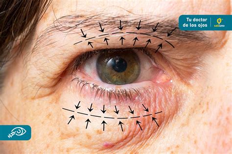 Oculoplastia Qu Es Y Para Qu Sirve Salauno