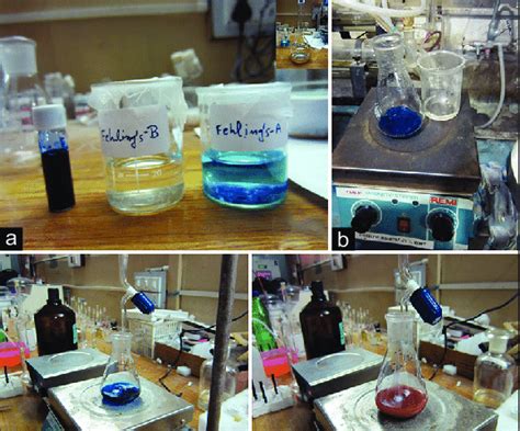 Armamentarium And Procedure A Reagents Used Methylene Blue