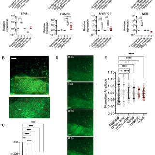 Sarcomeric Dysfunction And Calcium Release In Vivo And Innervated