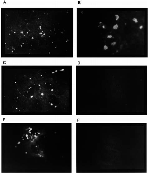 Indirect Immunofluorescence Assays Of Representative Samples For The