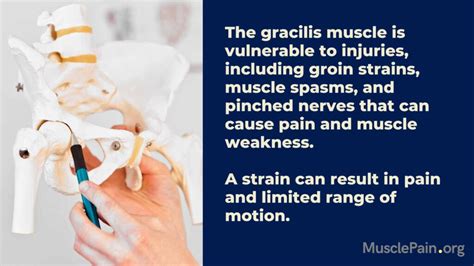 Gracilis Muscle Pain - Muscle Pain