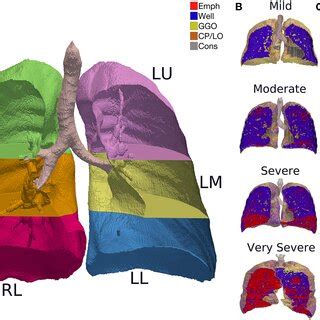 (A) CT image segmentation in a representative subject. R, right lung;... | Download Scientific ...