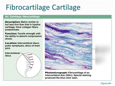 Fibrous Cartilage Diagram | Quizlet