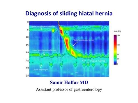 Sliding Type Hiatal Hernia