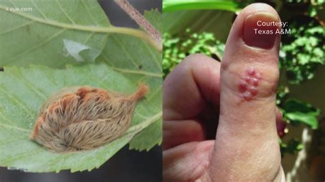 Cute and fluffy asp caterpillars pack painful sting | kcentv.com