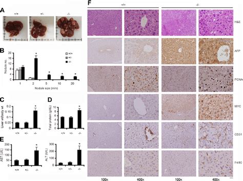 Genetic Deletion Of Igfbp Accelerates Den Induced Hcc Mice Were