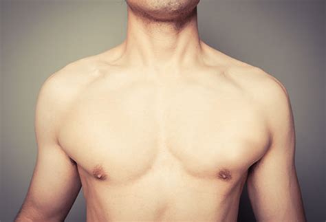 Gynecomastia Surgery Lawrenceville, GA | Suwanee Gynecomastia