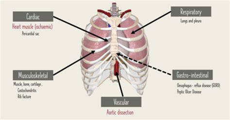 Chest Pain And Acute Coronary Syndrome Flashcards Quizlet