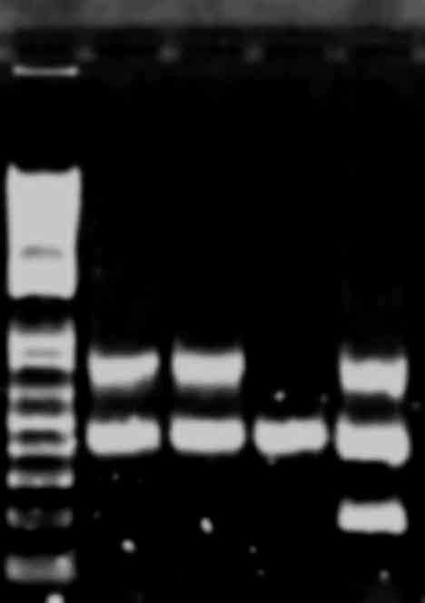 Agarose Gel Electrophoresis Of Multiplex Pcr Products Lanes 1 1 Kb