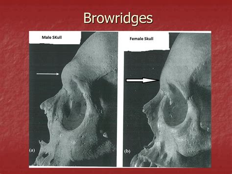 Skeletal Remains Objective To Learn How To Determine Sex And Ethnicity