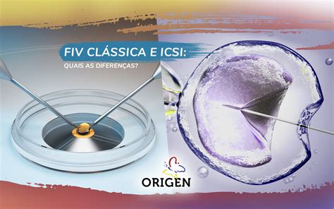 Fiv Cl Ssica E Icsi Quais As Diferen As Cl Nica Origen