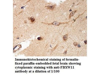 Anti FBXW11 Antibody Products Biocompare