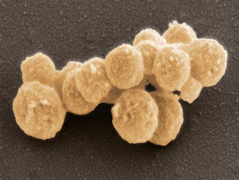 Synthetic Mycoplasma Bacteria Sem Photograph By Thomas Deerinck Ncmir