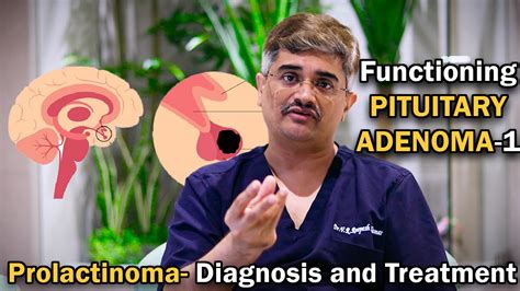 Functioning Pituitary Adenoma 1 Prolactinoma Diagnosis And Treatment