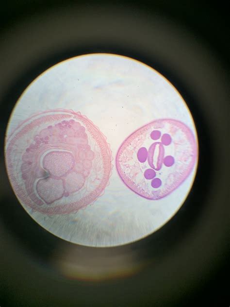 Malefemale Ascaris Diagram Quizlet