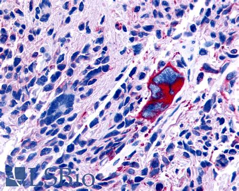 Pathplus Gpr Polyclonal Antibody Rabbit Anti Human Ihc Lsbio