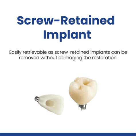 Screw-Retained Implant – ARUM Milling Centre