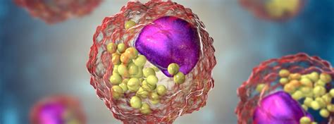 What causes high LDL cholesterol? - Step One Foods